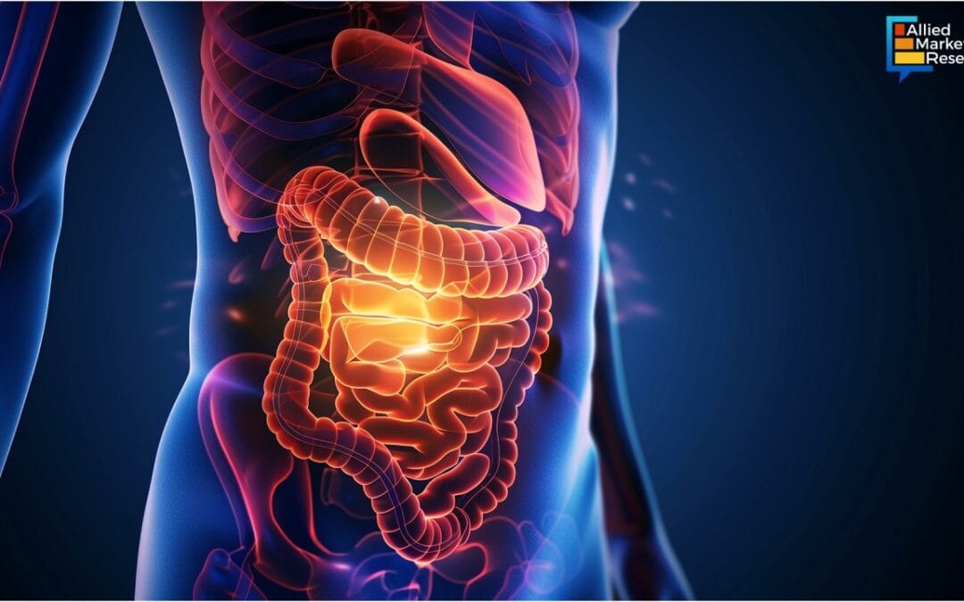 Could POIS Be Linked to Gut Health?