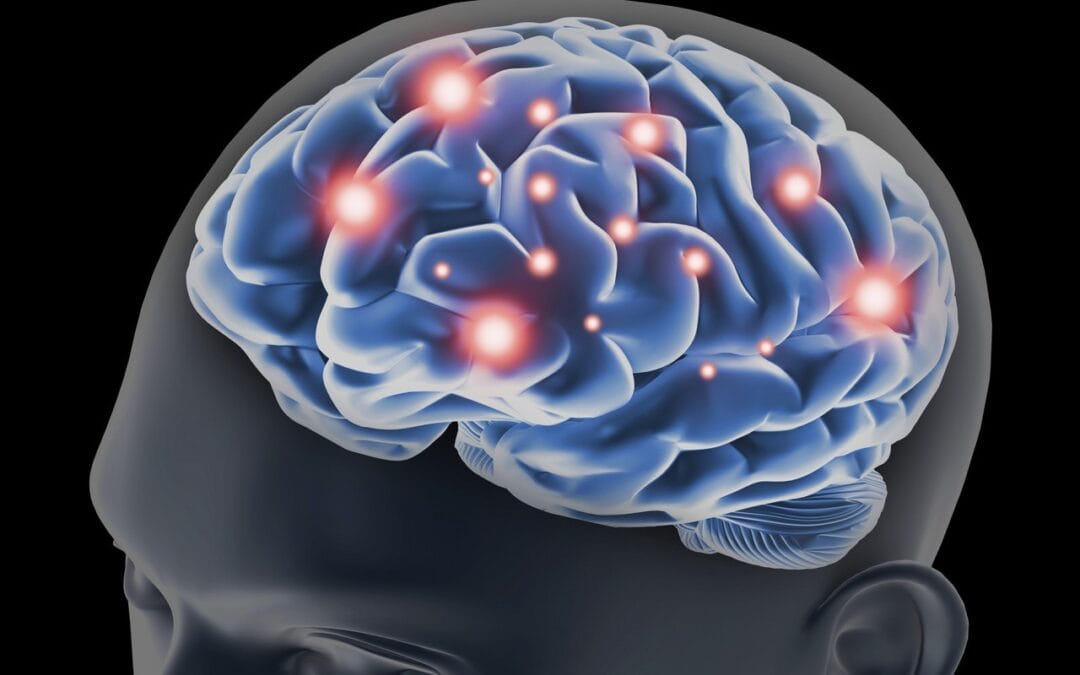 The Role of Dopamine and Serotonin in POIS